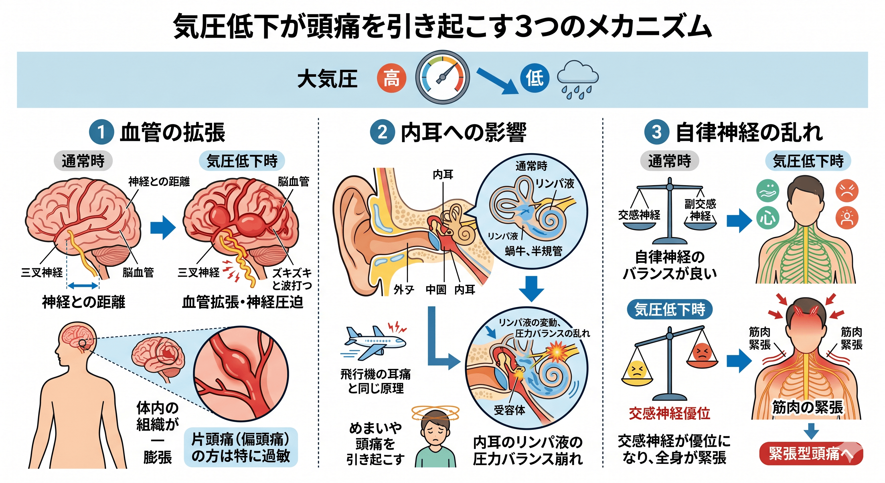 気圧低下による血管拡張・内耳変化・自律神経への影響を示す解説図
